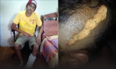 À Camp Thorel: un jeune dit avoir été agressé et volé par des proches