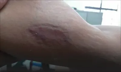 À Bel-Air/Rivière-Sèche : un policier mordu et sa collègue prise à la gorge lors d’une intervention 