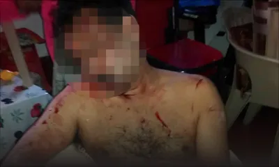 À Goodlands : accusé d’exhibitionnisme, un superviseur agressé