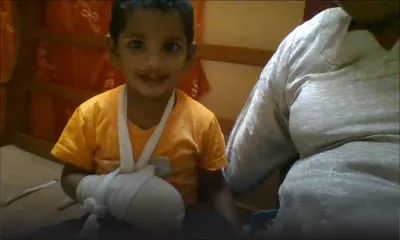 Son bébé brûlé au 3e degré: une famille escroquée de Rs 145 000