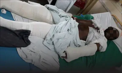 Agressé à coups de sabre : un pêcheur a eu ses tendons sectionnés