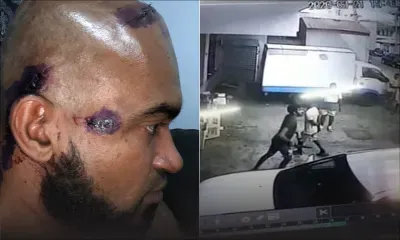 À Cassis : un agent de sécurité d’un supermarché sauvagement agressé