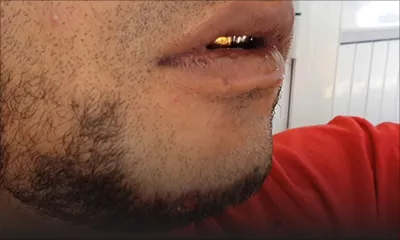 À Résidence Barkly : François Gowin, 28 ans, touché par balle