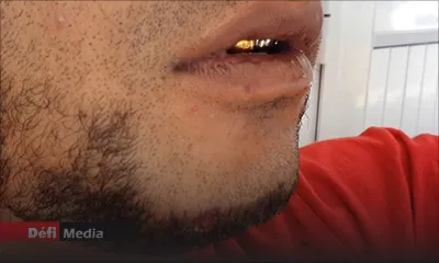 Touché par balle à Barkly : François Gowin a pu quitter l’hôpital 