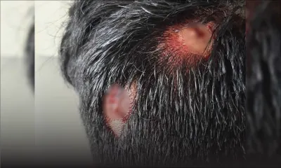 Dans un établissement à New-Grove : un collégien opéré après avoir été agressé par un autre 