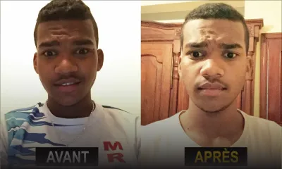 Aaron expulsé de l’école à cause de ses cheveux