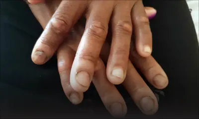 Séquestration et viol dans une maison de retraite : de graves allégations pèsent sur les gérants