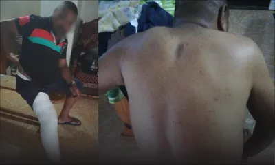 Agression dans un autobus - Ravi, le receveur : «Lin batt moi kuma ene lisien fou»