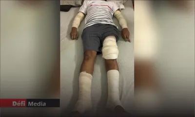 Quatre mois après avoir attaqué un homme à Port-Louis : les deux rottweilers restent introuvables