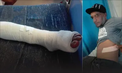 Rixe sanglante à Résidence-Barkly - Les frères Perrine : «Nous avons été injustement arrêtés»