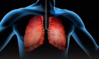 Tuberculose : 1 cas confirmé à l’île Maurice et 17 patients en traitement préventif, précise la Santé