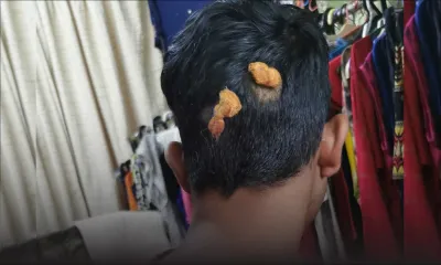 Un ado de 15 ans agressé avec une chaise en classe - La victime : «Tout a débuté à cause d’un morceau de papier et trois plumes»