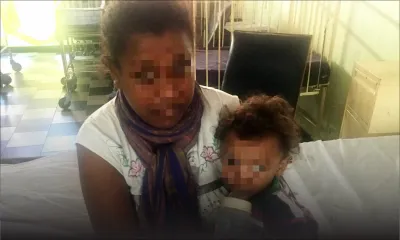 Maltraitance alléguée : un garçonnet contracte une maladie de la peau