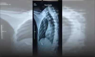 Gangs rivaux en milieu scolaire : un élève agressé au cutter par un autre 