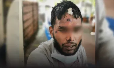 Amit agressé avec un pied-de-biche : «J’ai pensé que ma dernière heure était arrivée»