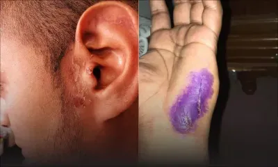 Agression au sabre : un jeune piégé par une « femme » connue sur Messenger 