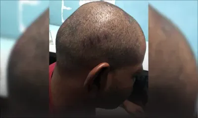 Brutalité policière alléguée - Me Anoup Goodaree : «Ce n’est pas à la police de faire justice»