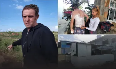 À Saint-François : un promeneur attaqué par des pitbulls et des rottweillers