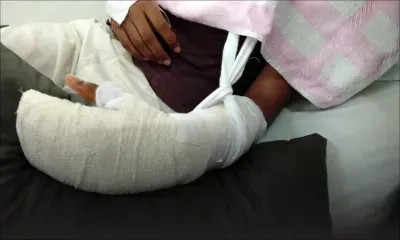 Victime de bullying : le tendon sectionné, un collégien de 13 ans risque un handicap