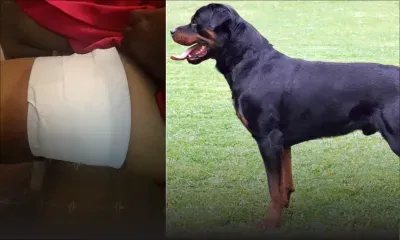 En se rendant à une boutique : une jeune femme attaquée par un chien de race