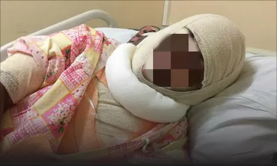 Pour une affaire d’argent : une jeune femme ébouillantée pendant son sommeil