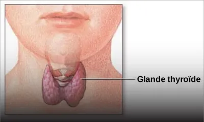 Thyroïde: siège de nombreux maux