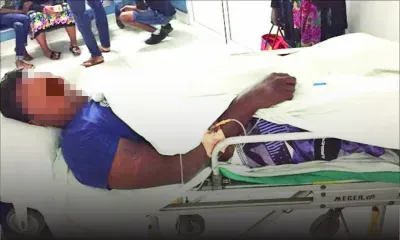 Accident à Bras-d’Eau : un homme de 23 ans amputé du pied droit