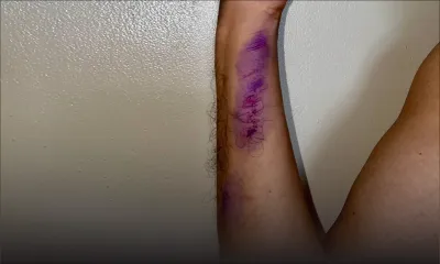 Rajiv, 69 ans : «Mo nepli kapav sorti akoz sa laper-la ankor laem»