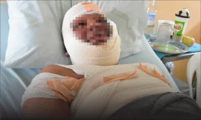 À Forest Side: il se brûle en nettoyant les vitres de sa cuisine