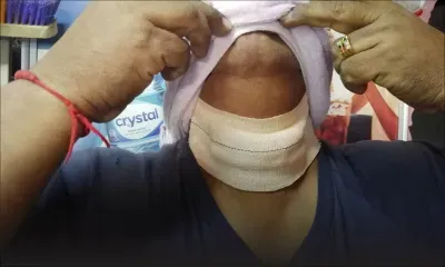 Un boutiquier agressé pour une cigarette - La victime : «Mank enn milimet li transe la venn mo lagorz»