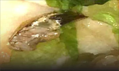 Du cafard dans un morceau de poulet