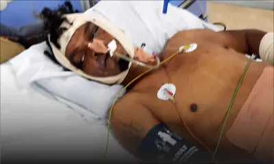 Pour avoir adressé la parole à la femme du voisin : il est sauvagement agressé par le mari jaloux