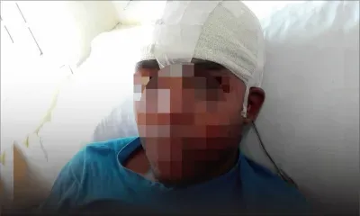 Après un match de foot : un ado agressé à coups de brique à la tête