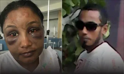 Ligotée, tabassée et défigurée par son mari - Yashna : «Je ne pensais pas survivre à cette atrocité» 