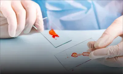  Coronavirus : deux enfants d'un et cinq ans contaminés dans l'est de la France