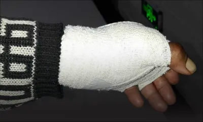 Agressé par un voleur masqué : un boutiquier de 85 ans a le tendon sectionné