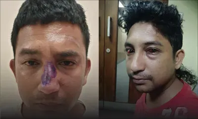 Au poste de police de Trou Fanfaron : les jumeaux Chantoiseau allèguent avoir été victimes de brutalité policière 