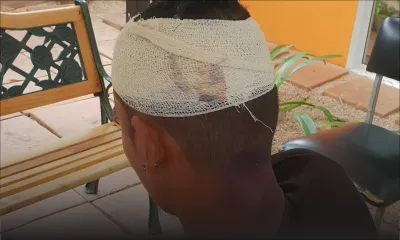 Dans l’enceinte du poste de police de Vallée-Pitot : il reçoit de violents coups de canif à la tête