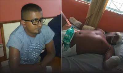 Aslam Noorsing condamné à vivre avec deux poignets sectionnés