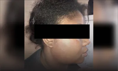 Agressée par son conjoint - Sonia, 23 ans : «Monn tromatize telma monn gagn bate»