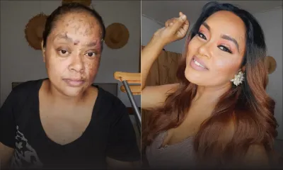 Victime d’un grave accident en février dernier : le combat sans relâche d’Estelle Riche