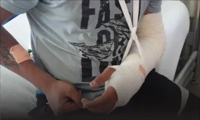 À Morcellement Les Guibies, Pailles : Il agresse son beau-fils de 16 ans avec une pioche