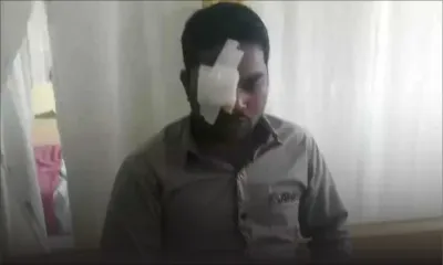 Vol d'une rare violence à Goodlands : un Bangladais se fait arracher l'œil avec un tournevis