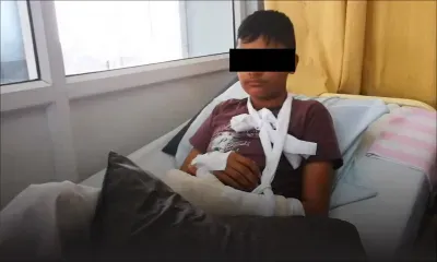 Harcèlement et agression au SSS de Vacoas : Ouzair Jeetoo pourrait perdre l’usage de sa main gauche