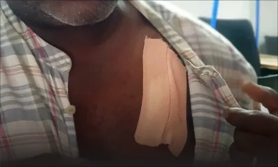 Il dénonce la prostitution dans la localité : un père de famille agressé avec un tire-bouchon à Cassis