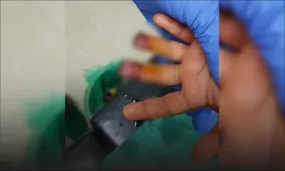 Une fillette de 3 ans blessée à l'école pré-primaire : bras de fer entre ses parents et la direction de l'école