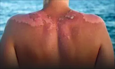 The heat is back: How to survive summer