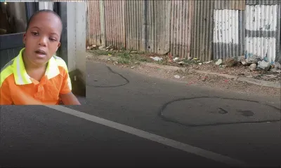 Clarino Edouard, 9 ans, victime d’un second accident en l’espace d’un an 