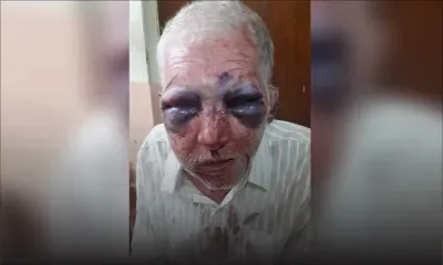 Sur fond de vengeance : un retraité défiguré à coups de pierre par un jeune de 18 ans