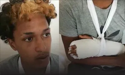 Pailles : un jeune homme accuse son oncle de l’avoir agressé au sabre